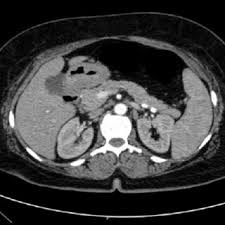 Micro-CT cross-sectional image showing internal porosity and micro-architecture