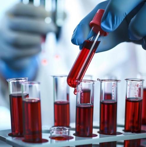 Hematology and blood interaction studies