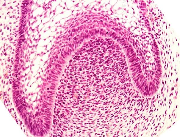 Paraffin-embedded tissue block being trimmed and prepared for microtome sectioning.