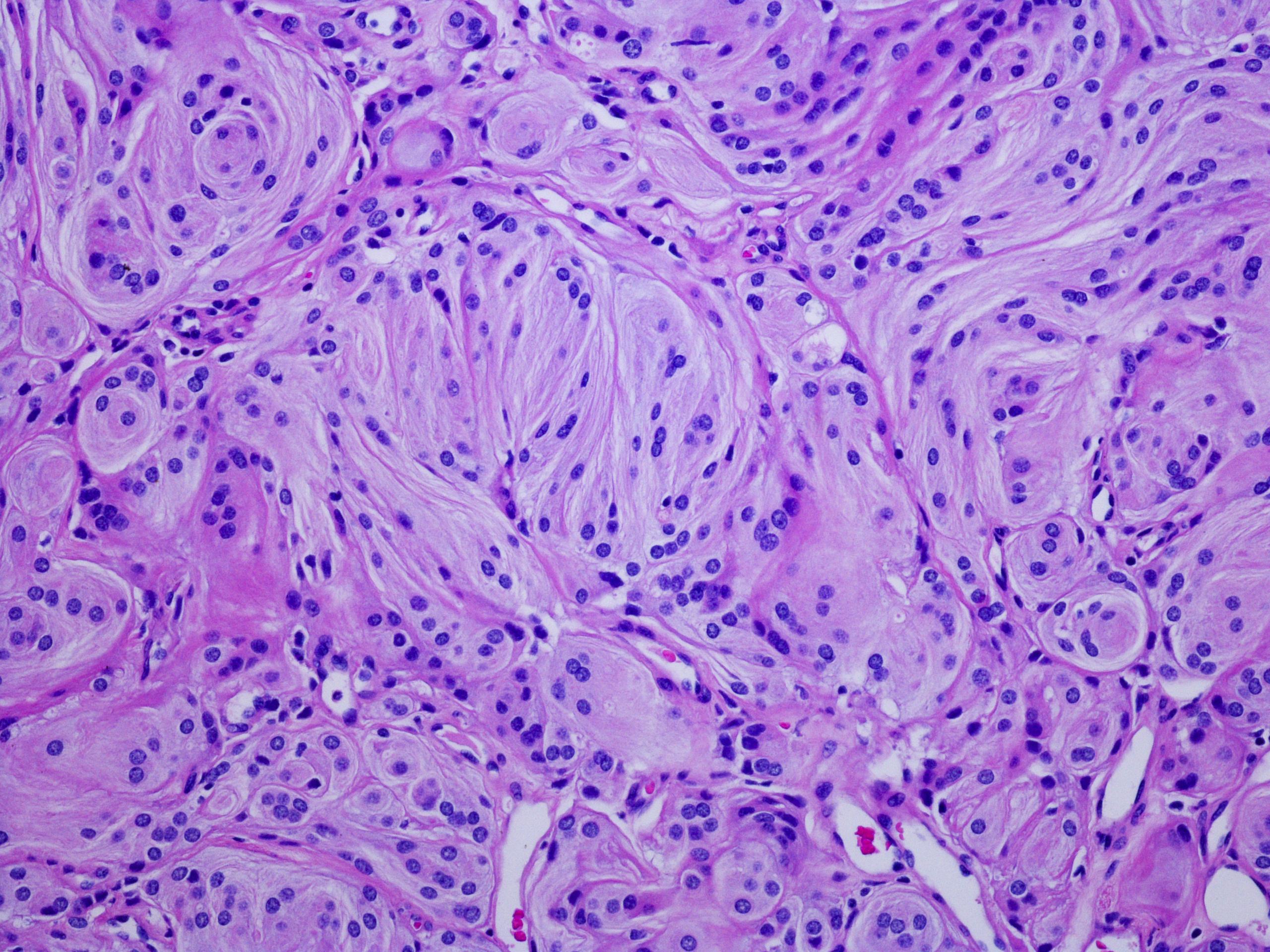 Advanced Histology and microscopy imaging analysis showing tissue morphology and biomaterial interactions.