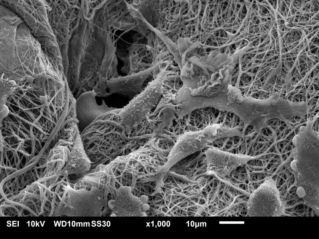 Cell growth on Decellularization