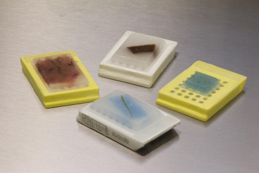 Tissue Processing & Sample Preparation