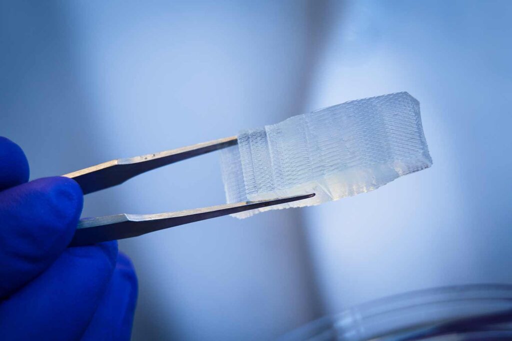 3d-printed-implants at Materials Metric