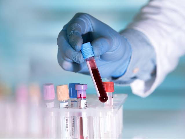 Biotechnology Testing & Diagnostic Development Support