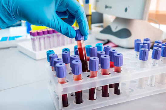 Biotechnology Testing & Diagnostic Development Support
